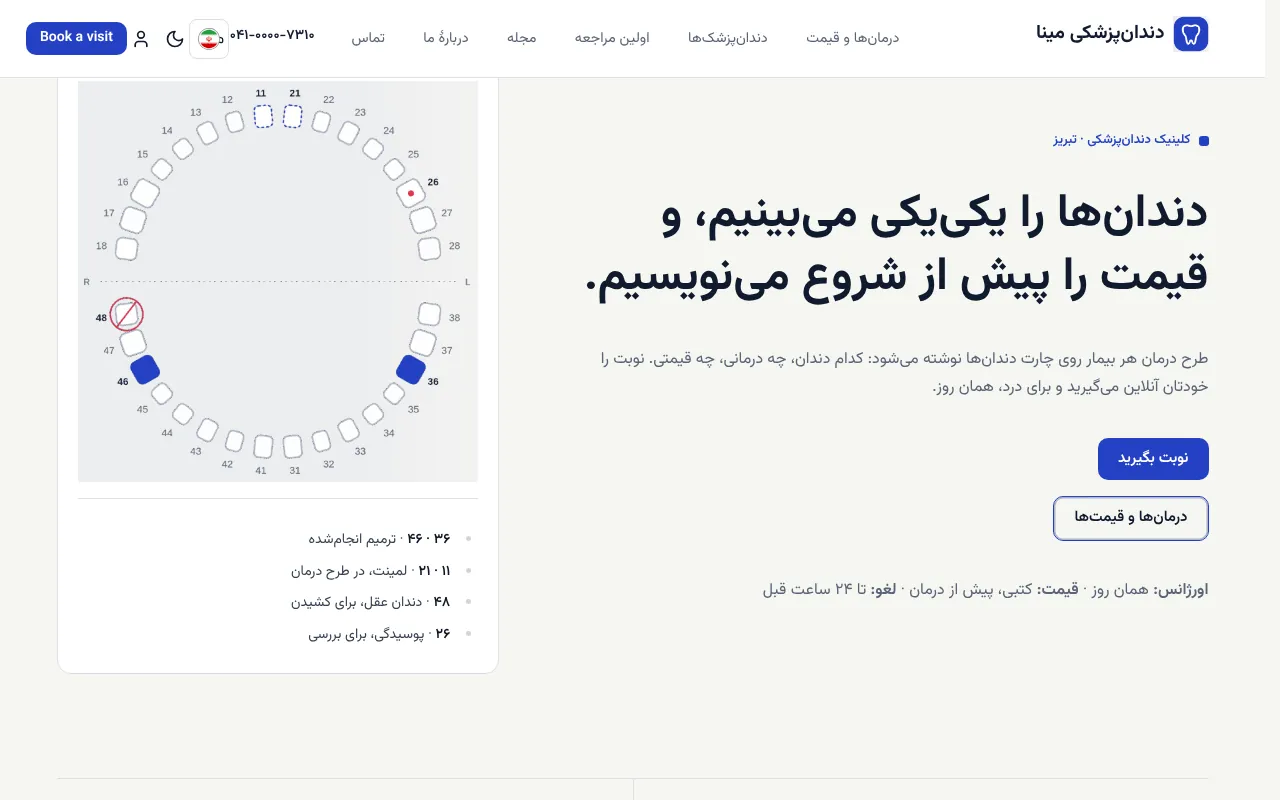 طرح درمان، روی چارت دندانها
